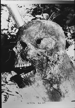 [ Skull exhumed from Mowat cemetery site ]
